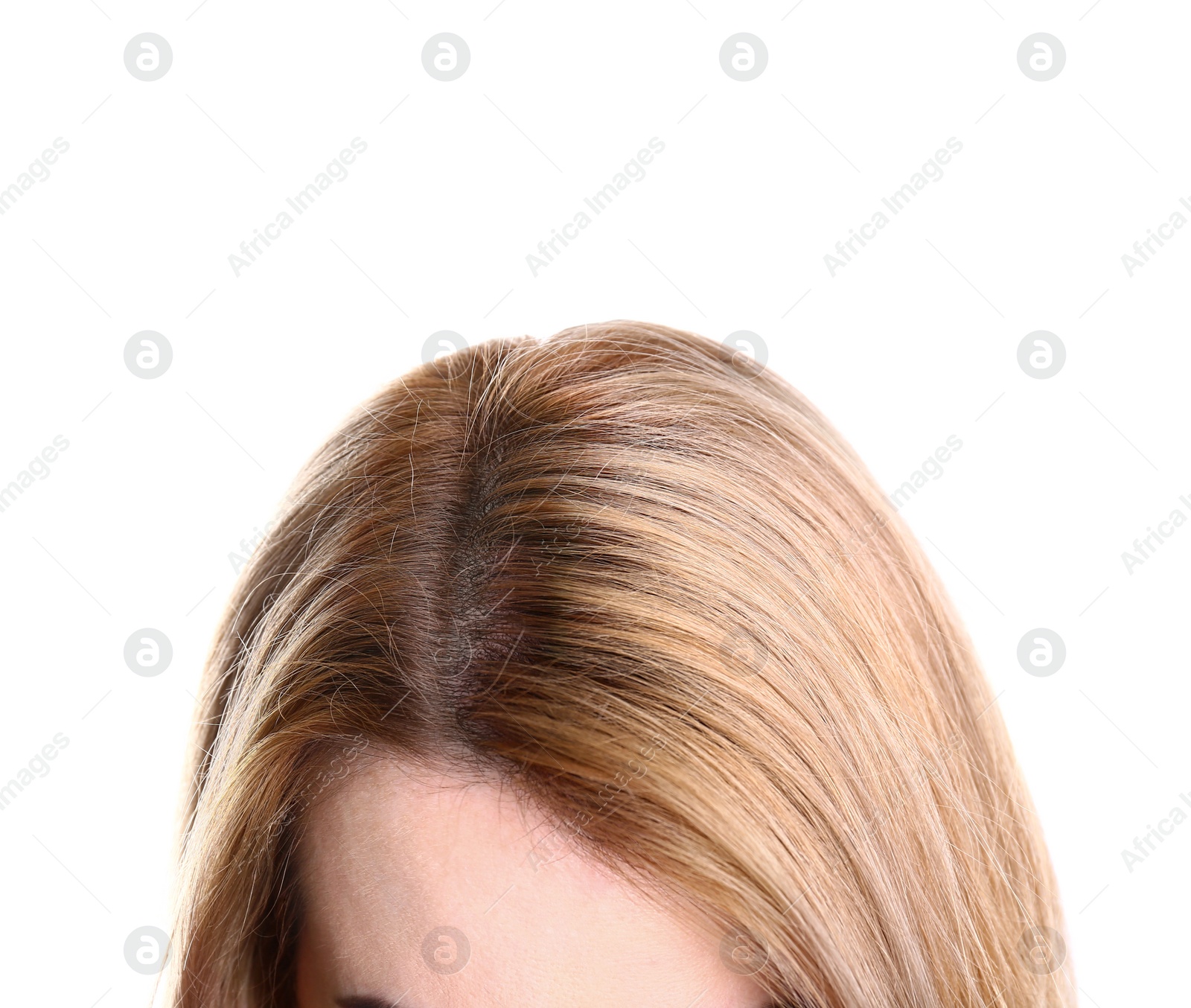 Photo of Young woman with hair loss problem on white background, closeup