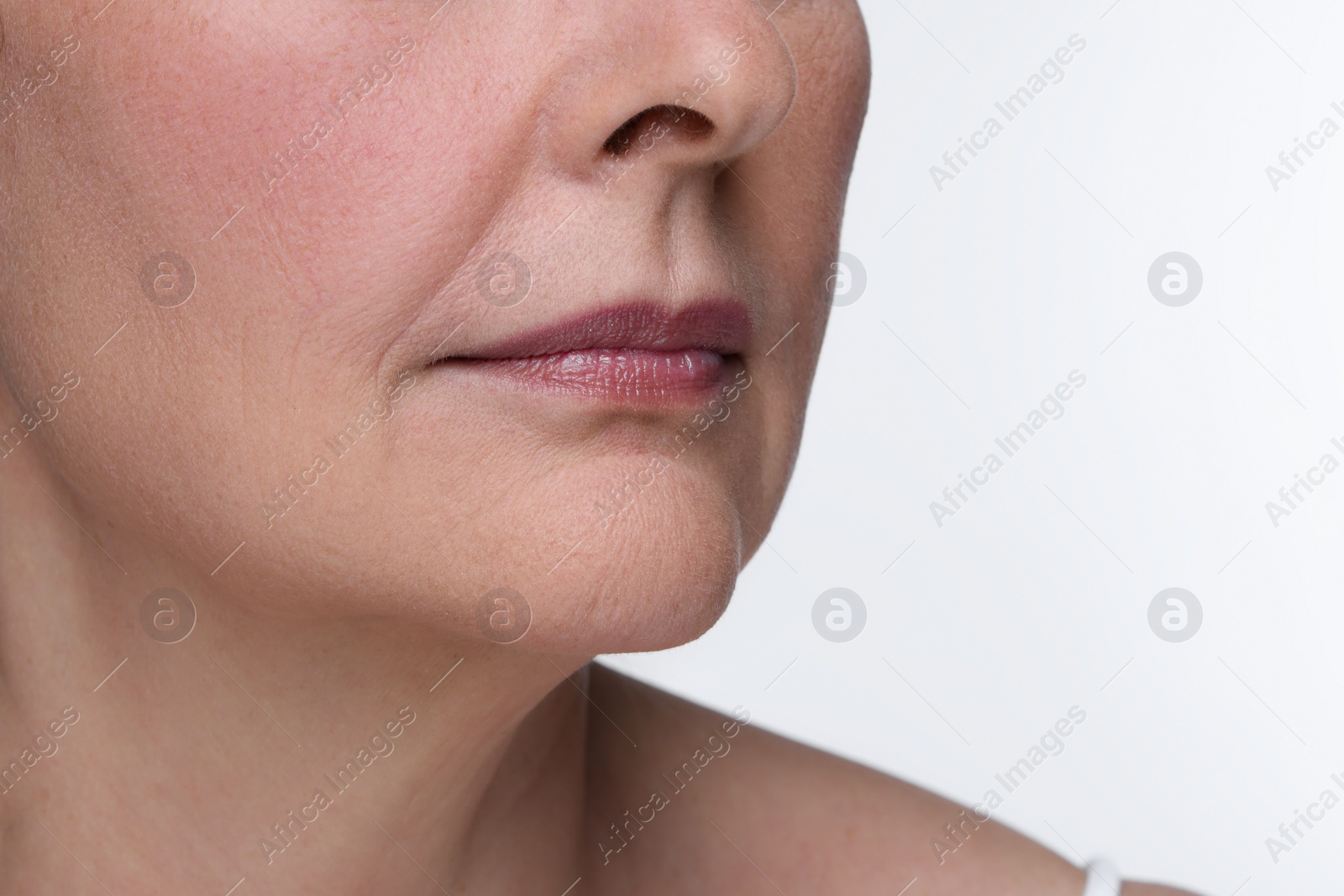 Photo of Senior woman with aging skin on white background, closeup. Rejuvenation treatment