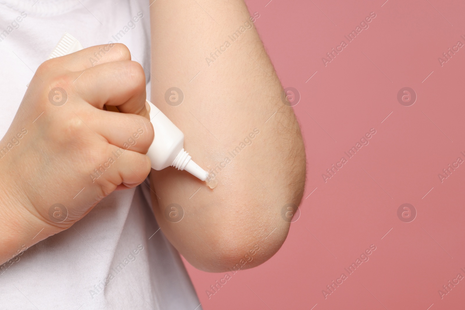Photo of Child applying ointment onto elbow against pink background, closeup. Space for text