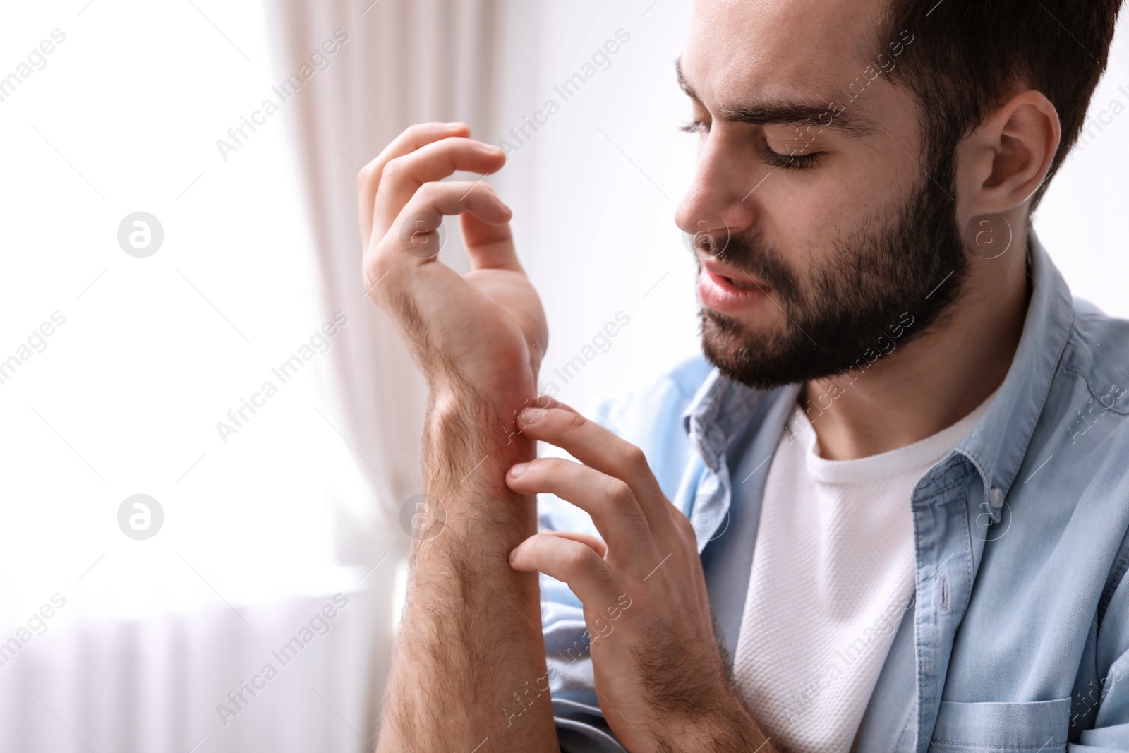 Photo of Young man scratching hand indoors, space for text. Allergies symptoms