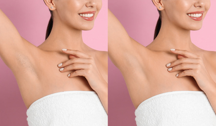 Collage of woman showing armpit before and after epilation on pink background, closeup 