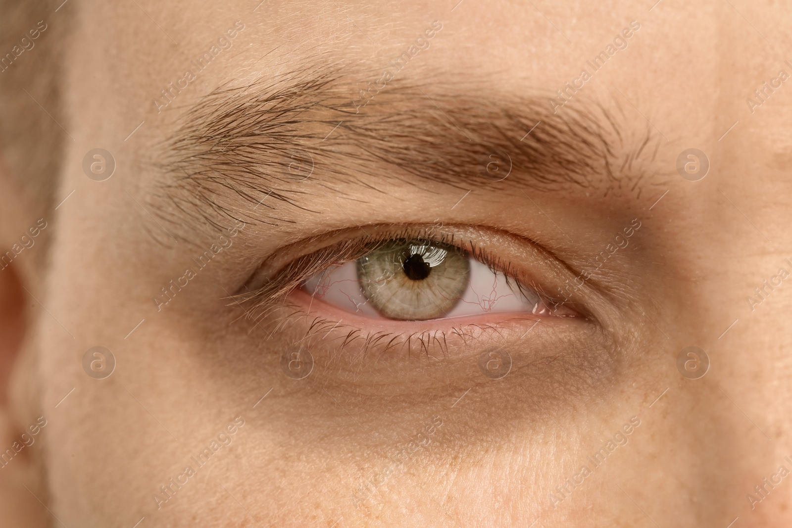 Image of Tired man with dark circle under eye, closeup