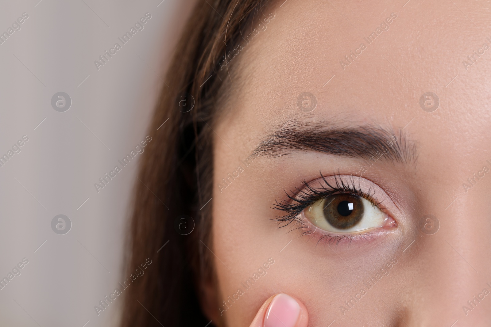 Photo of Woman with yellow eyes on blurred background, closeup. Symptom of hepatitis