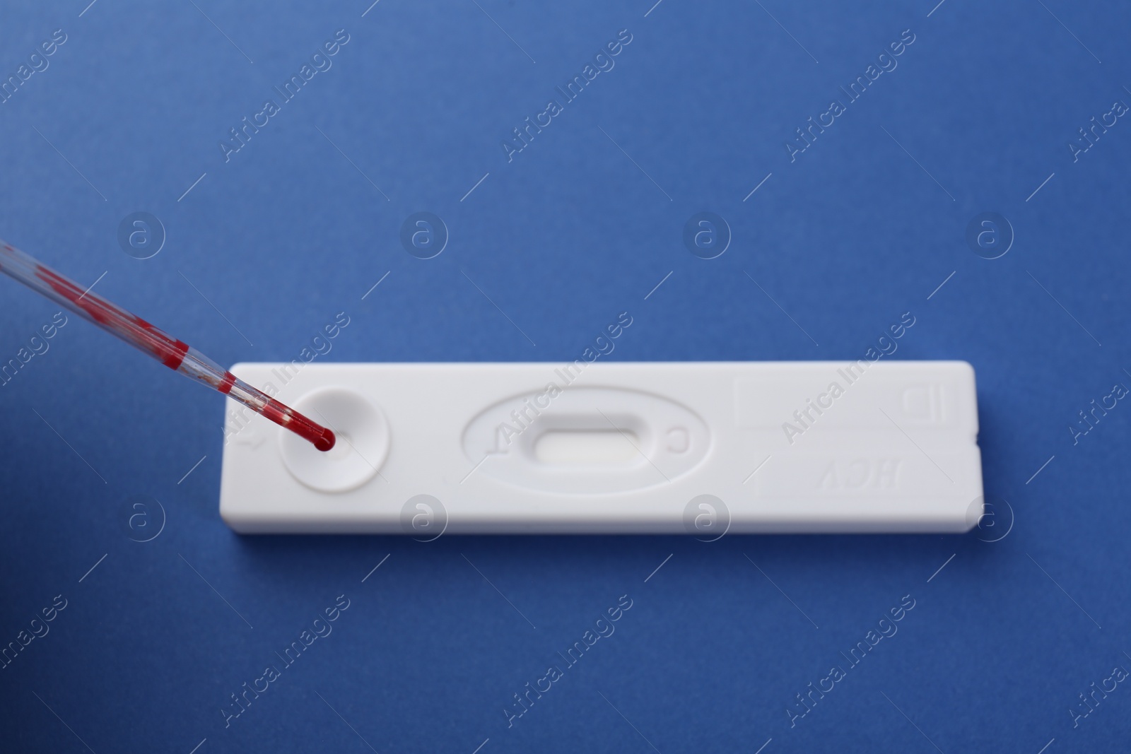 Photo of Dropping blood sample onto disposable express test cassette with pipette on blue background, above view