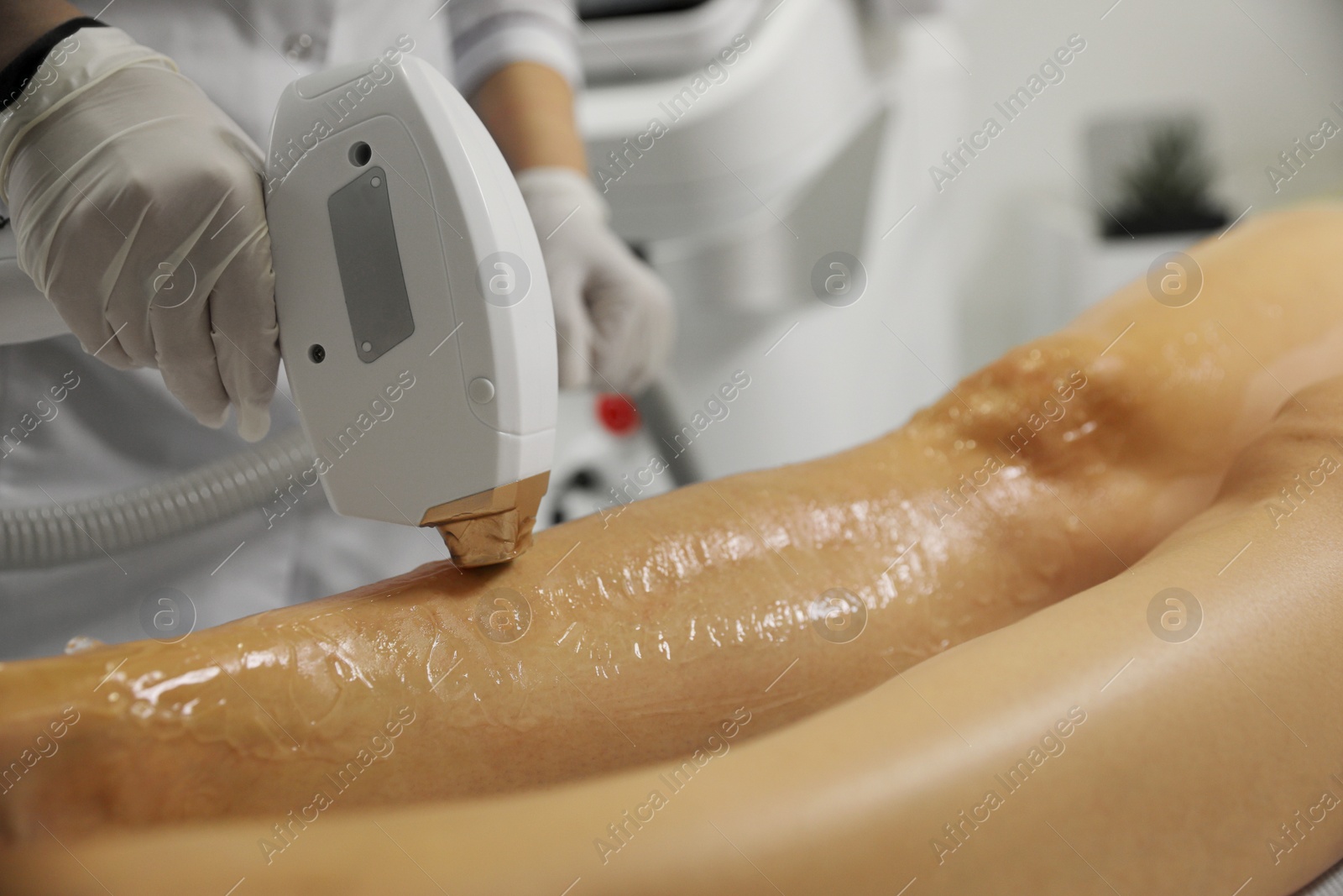 Photo of Woman undergoing laser epilation procedure in beauty salon, closeup