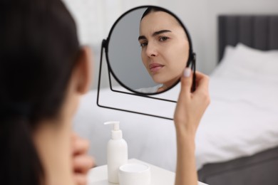 Woman with dry skin looking at mirror indoors