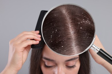 Woman suffering from dandruff on grey background, closeup. View through magnifying glass on hair with flakes