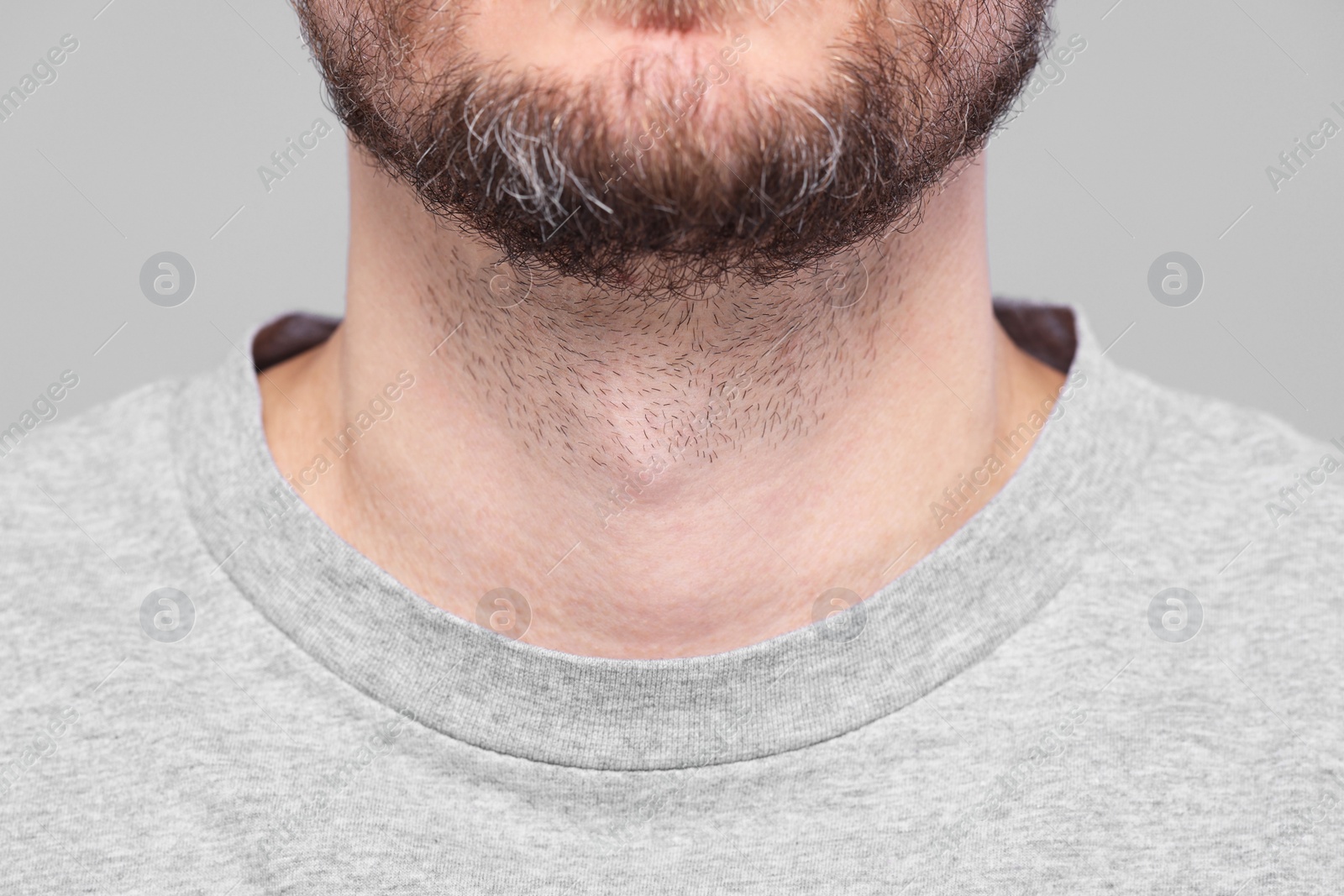 Photo of Closeup view of man with normal skin on grey background