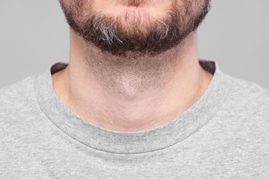 Closeup view of man with normal skin on grey background