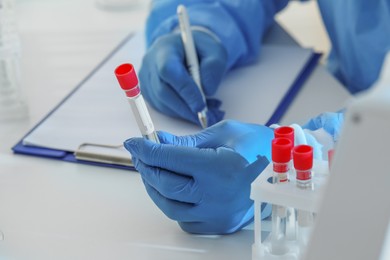 Photo of Scientist working at table, closeup. Medical research