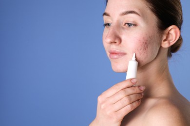 Young woman with acne problem applying cosmetic product onto her skin on blue background. Space for text