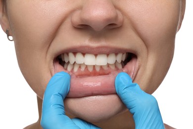 Photo of Woman showing healthy gums on white background, closeup