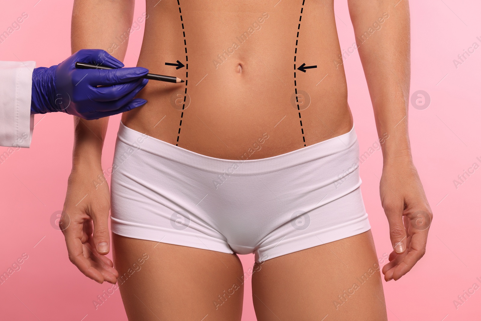 Image of Woman preparing for cosmetic surgery, pink background. Doctor drawing markings on her abdomen, closeup