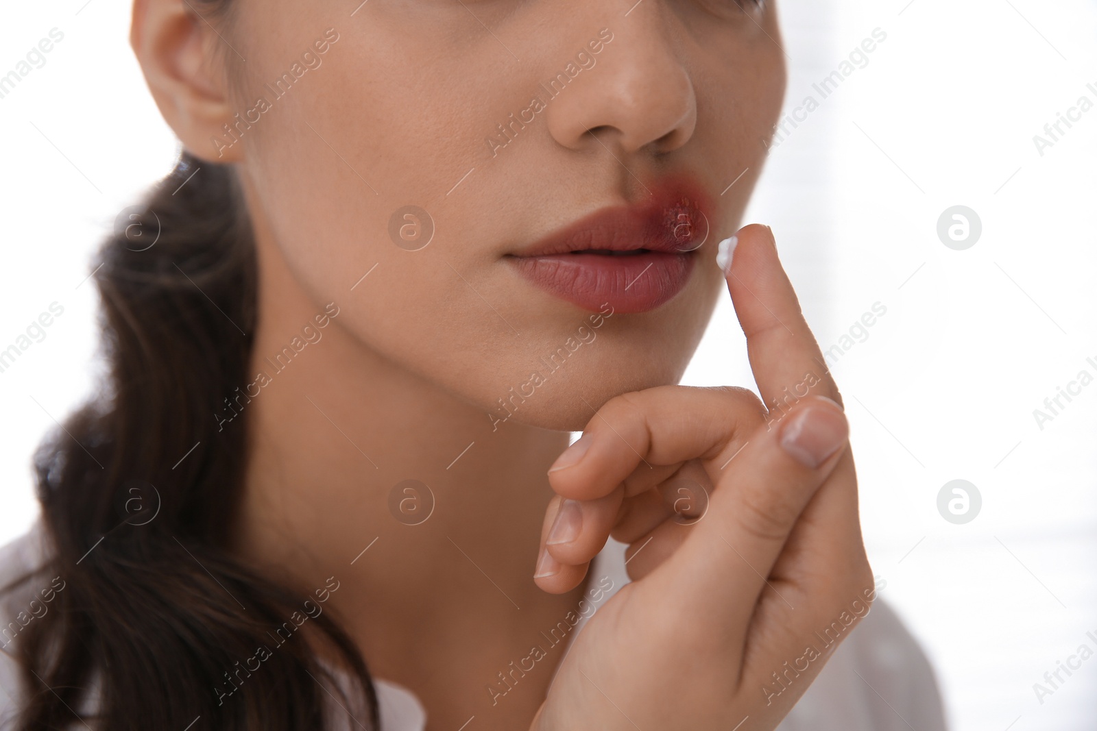 Photo of Woman with herpes applying cream on lips against light background, closeup