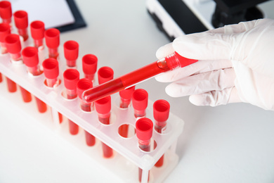 Scientist holding test tube with blood sample in laboratory, closeup. Virus research