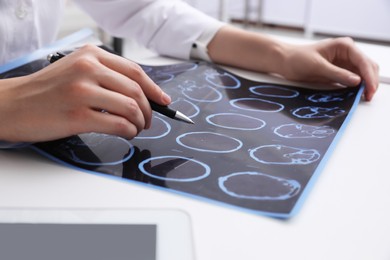 Photo of Doctor examining MRI images of patient with multiple sclerosis at white table in clinic, closeup
