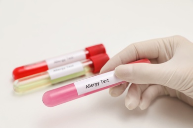 Doctor holding tube with label ALLERGY TEST on light background, closeup