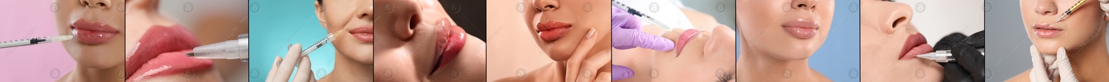 Image of Collage with photos of women during procedures of lip augmentation and permanent makeup, closeup. Banner design