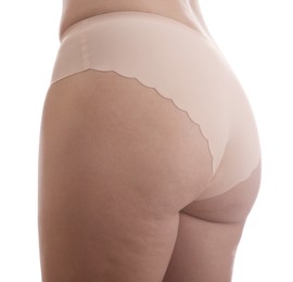 Photo of Woman with cellulite on white background, closeup