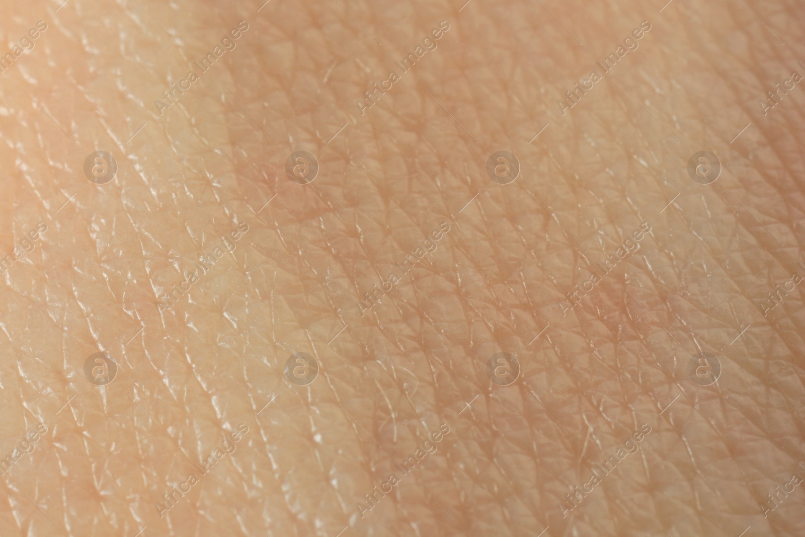 Photo of Texture of dry skin as background, macro view