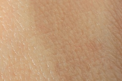 Texture of dry skin as background, macro view