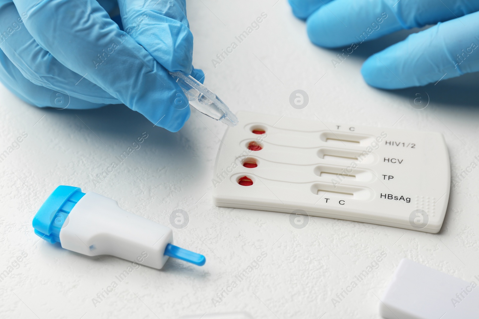 Photo of Doctor dropping buffer solution onto disposable multi-infection express test cassette at white table, closeup