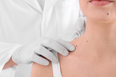 Photo of Dermatologist examining patient in clinic, closeup view