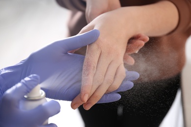 Photo of Applying burn spray onto injured skin, closeup