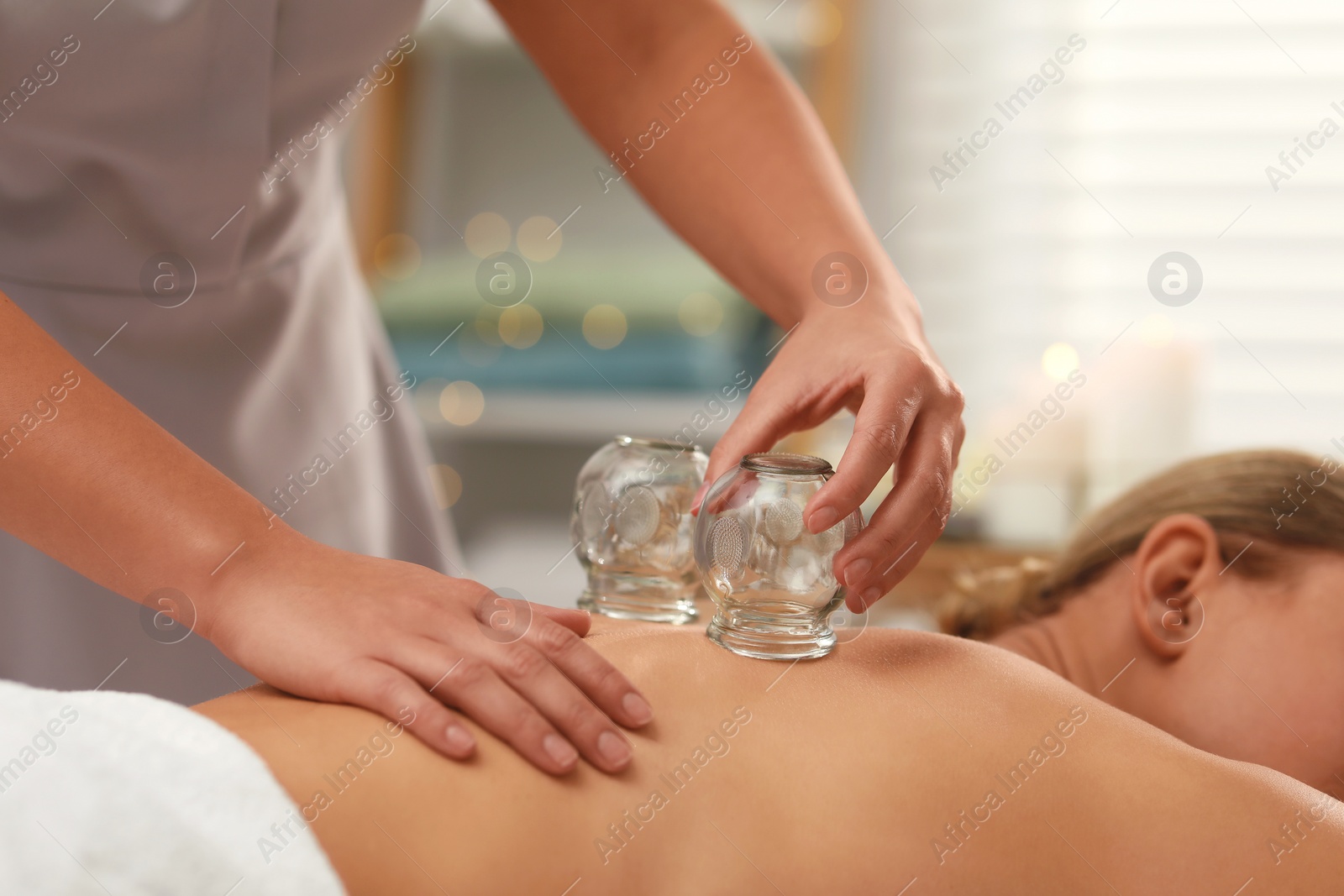 Photo of Therapist giving cupping treatment to patient indoors, closeup