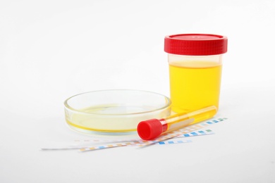 Photo of Laboratory ware with urine samples for analysis on white background