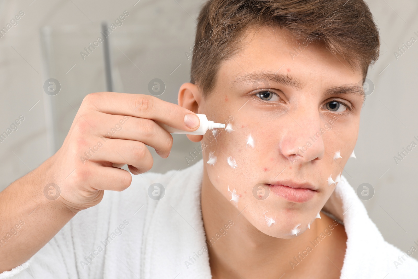 Photo of Teen guy with acne problem applying cream in bathroom