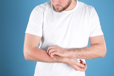 Photo of Man scratching forearm on color background, closeup. Allergy symptoms