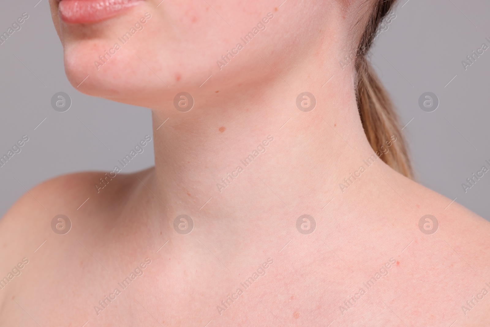 Photo of Closeup view of woman with normal skin on grey background