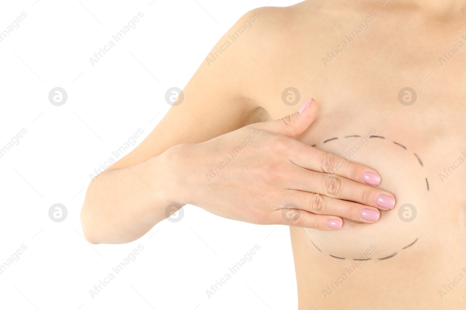 Photo of Young woman with marks on breast for cosmetic surgery operation against white background, closeup