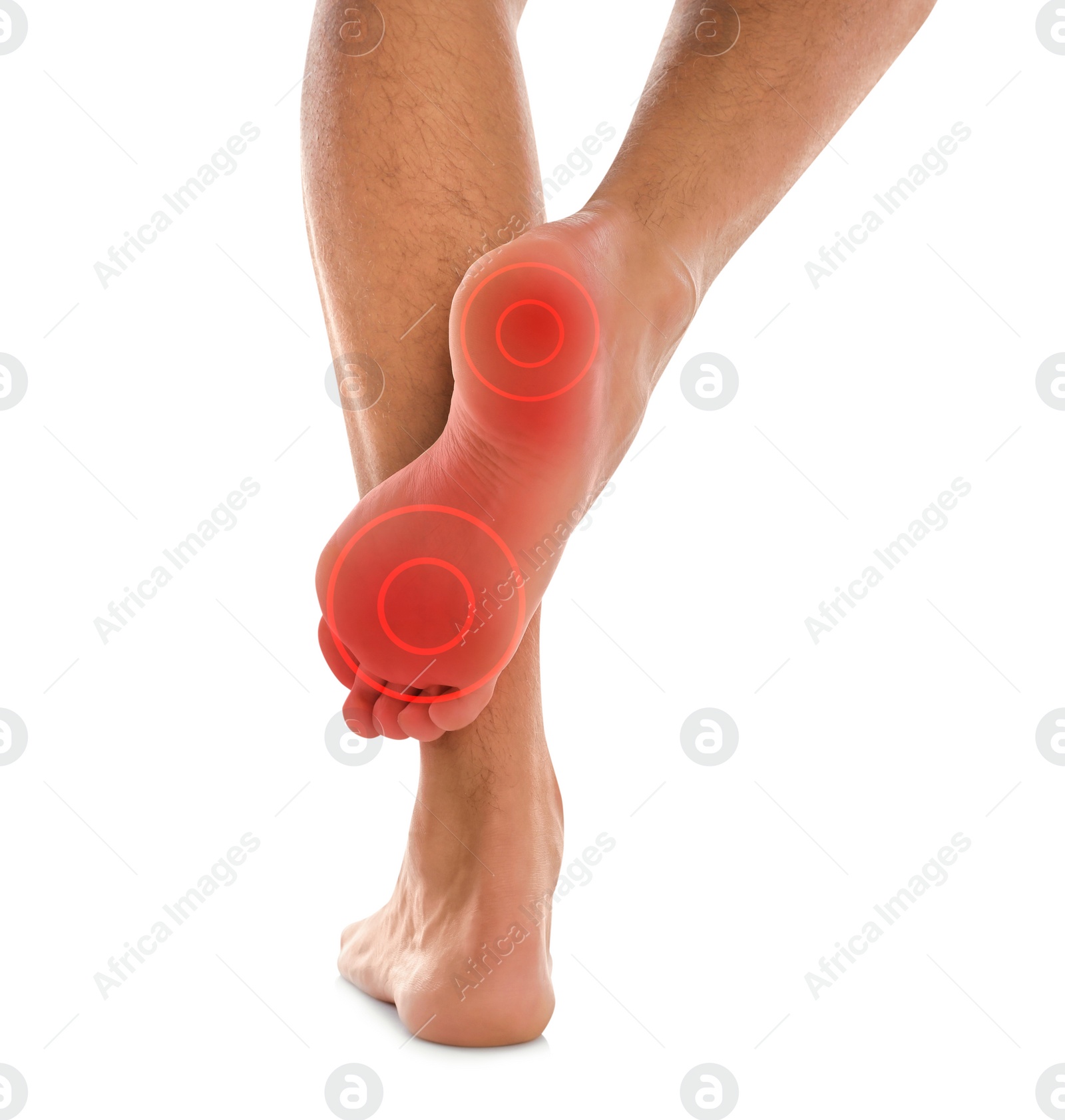 Image of Man suffering from foot pain on white background, closeup