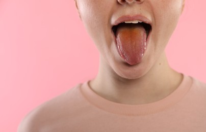 Photo of Gastrointestinal diseases. Woman showing her yellow tongue on pink background, closeup. Space for text