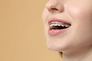 Smiling woman with dental braces on beige background, closeup. Space for text