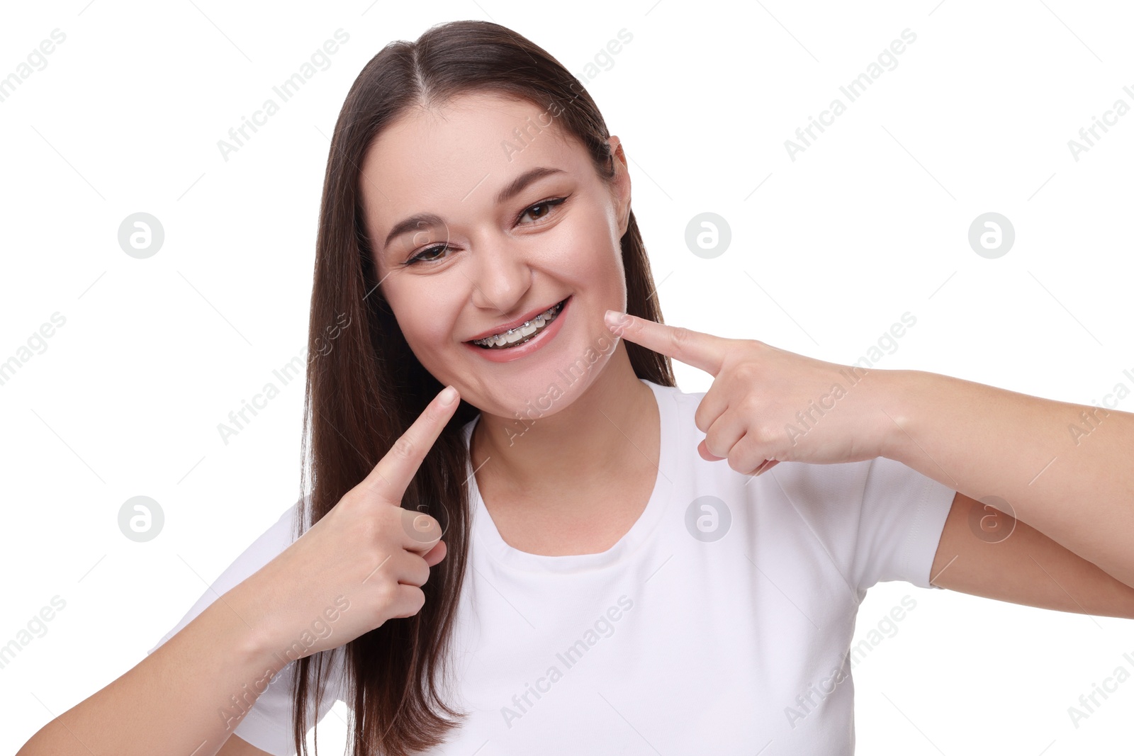 Photo of Smiling woman with dental braces on white background