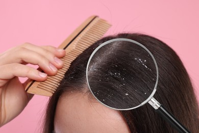 Woman suffering from dandruff on pink background, closeup. View through magnifying glass on hair with flakes