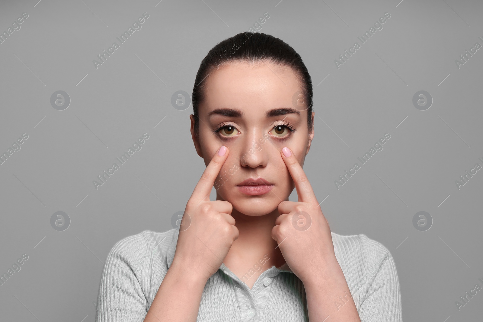 Photo of Woman checking her health condition on grey background. Yellow eyes as symptom of problems with liver