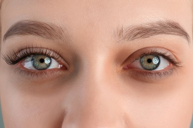 Image of Tired young woman with dark circles under eyes, closeup