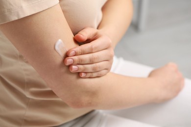 Photo of Young woman with dry skin applying cream onto her arm indoors, closeup