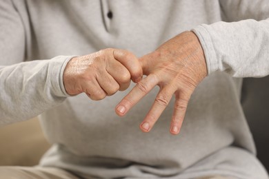 Photo of Senior man suffering from pain in hand, closeup. Rheumatism symptom