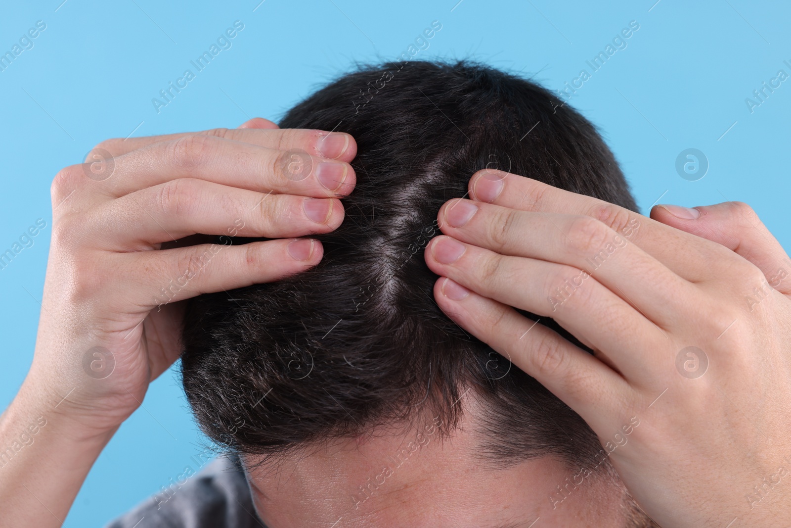 Photo of Man examining his hair and scalp on light blue background, closeup