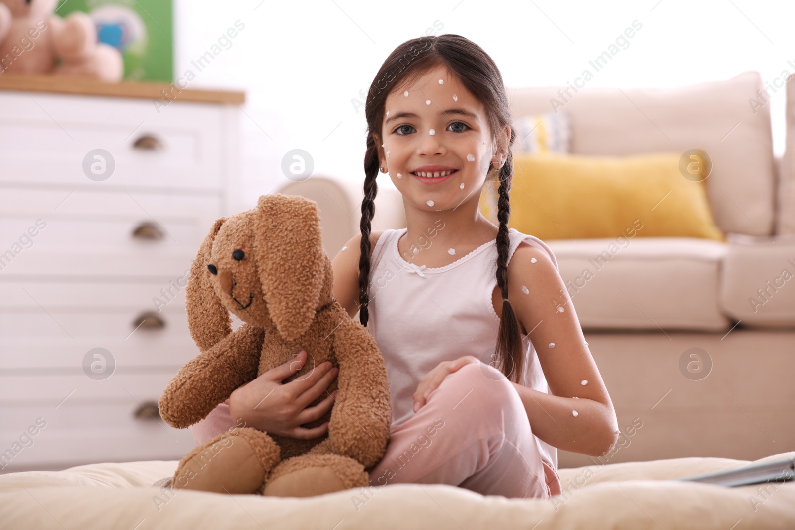 Photo of Little girl with chickenpox playing at home