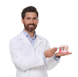 Dentist holding educational model of dental implant on white background