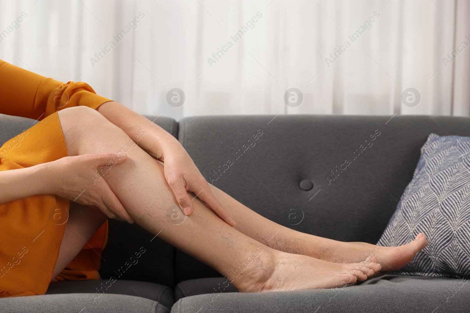 Photo of Barefoot woman with varicose veins resting on sofa in room, closeup