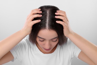 Photo of Woman with dandruff problem on white background