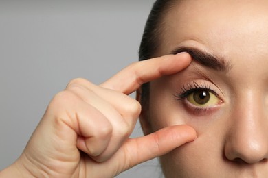 Photo of Woman checking her health condition on grey background, closeup. Yellow eyes as symptom of problems with liver