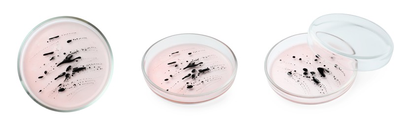 Collage of Petri dish with culture on white background, different angles